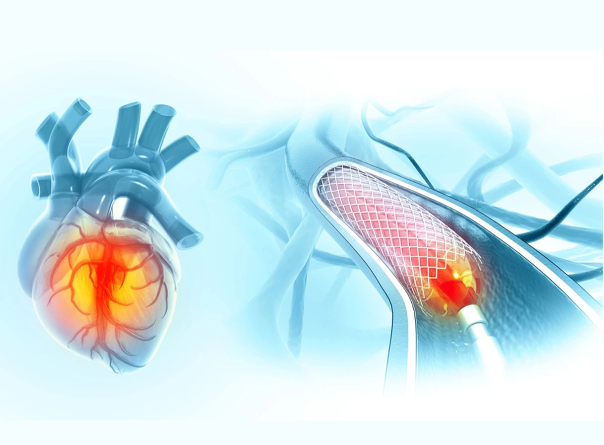 heart attack in young adults